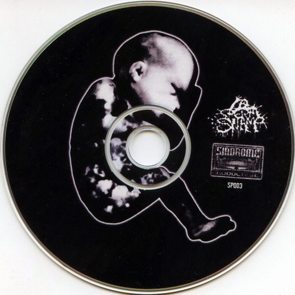 spermswamp-if-abortion-cd