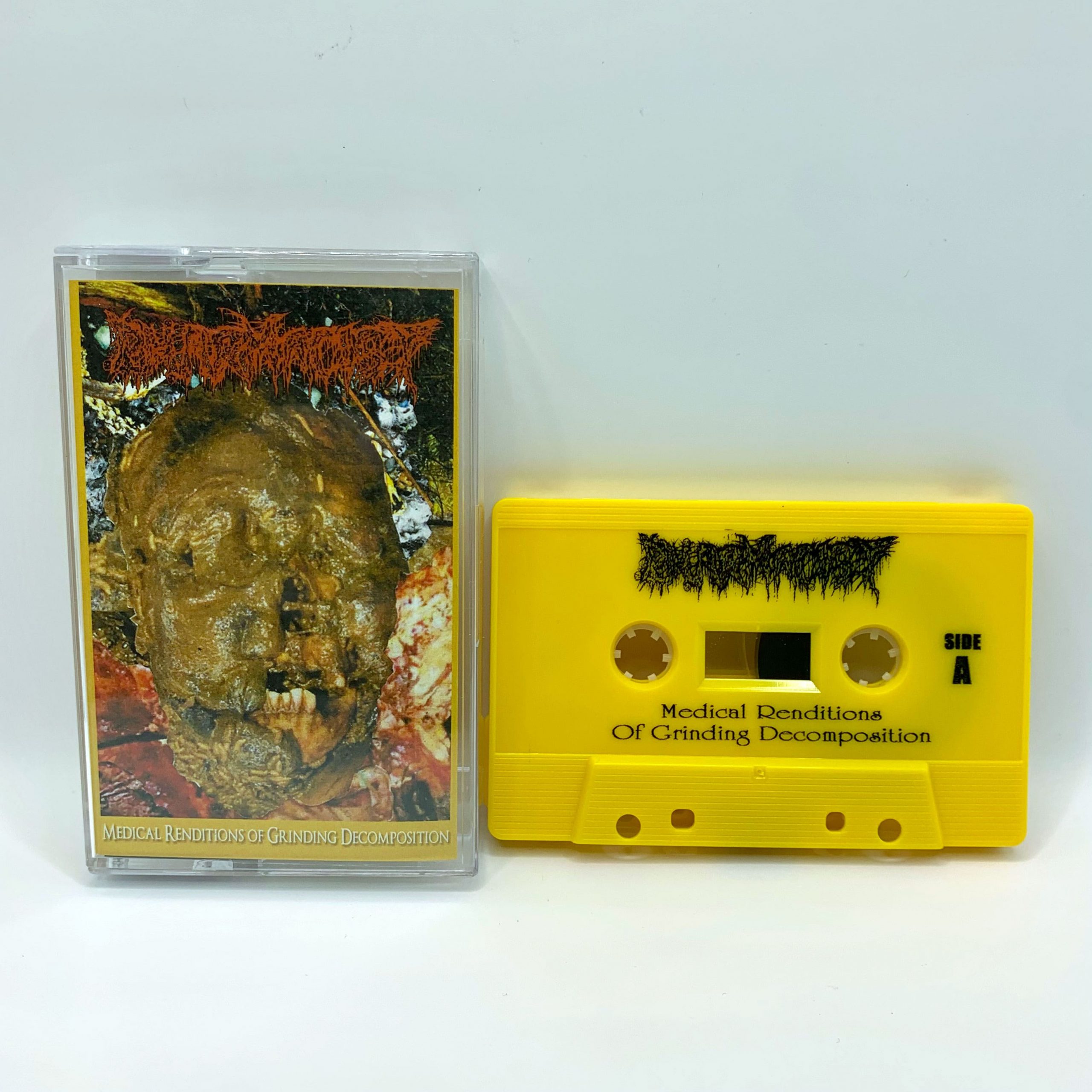 Pharmacist-fist-full-cassette-min