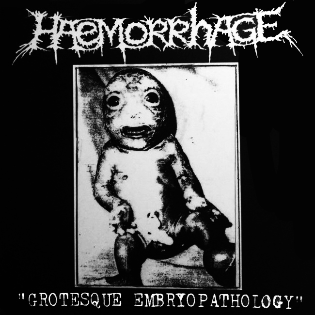 Haemorrhage—Grotesque-Embryopathology